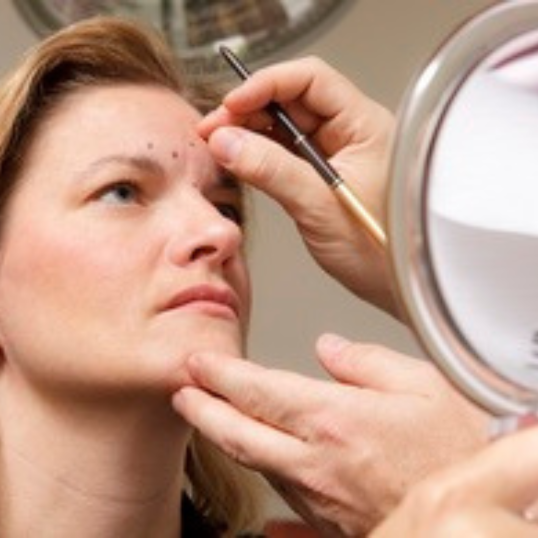 woman having cosmetic surgery