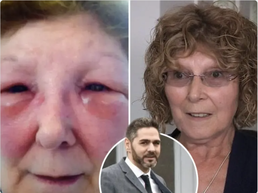 MARCELLE KING WHO FELL VICTIM TO BOGUS DOCTOR OZAN MELIN JOINS SAVE FACE AS PATIENT AMBASSADOR