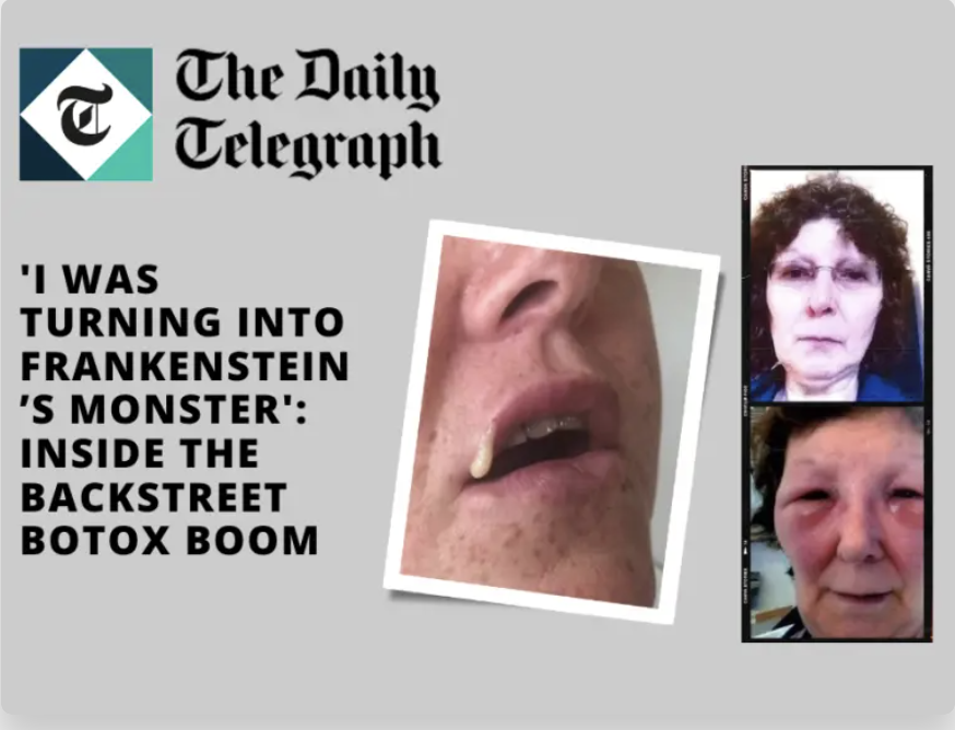 The Telegraph – ‘I was turning into Frankenstein’s monster’: Inside the backstreet Botox boom